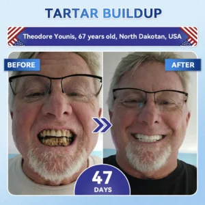 GаrаgеLіnе® Tideglusib Fast‑Dissolving Tooth & Gum Repair Oral Strips