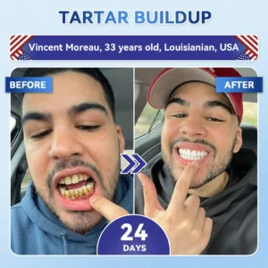 GаrаgеLіnе® Tideglusib Fast‑Dissolving Tooth & Gum Repair Oral Strips